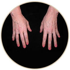 Sclerotherapy Orland Park IL